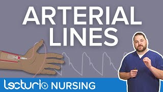 Arterial Lines Placement Locations amp Line Pressure Monitoring  Lecturio Critical Care Nursing [upl. by Atnahsa]