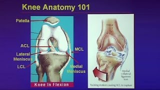 Common Traumatic Knee Injuries Oh My Aching Knee [upl. by Arthur364]