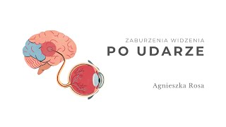 Zaburzenia widzenia po udarze Agnieszka Rosa [upl. by Atsirtal]