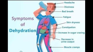 13 Dehydration Symptoms Everyone Should Know [upl. by Mitchel]