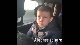 absence seizurepetit mal seizure [upl. by Beeson]