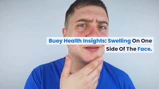 Swelling on One Side of the Face Common Causes and When to Seek Medical Care  BuoyHealthcom [upl. by Baram]