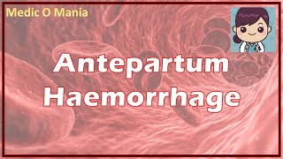 Antepartum Hemorrhage  APH Management प्रसवपूर्व रक्तस्राव प्रबंधन HINDI [upl. by Nimsaj]