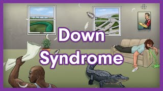 Down Syndrome Trisomy 21  USMLE Step 1 Mnemonic [upl. by Retse]