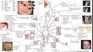 Cranial Nerves Part 1 [upl. by Karub671]