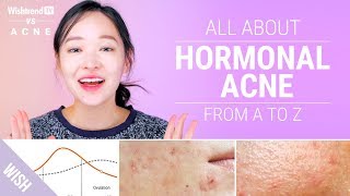 How to Cure Hormonal Acne  Lifestyle amp Skincare Tips  Wishtrend TV VS ACNE [upl. by Jessabell]