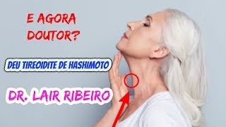 E AGORA DOUTOR LAIR RIBEIRO DEU TIREOIDITE DE HASHIMOTO TEM TRATAMENTO TIREOIDE [upl. by Atnohsal]