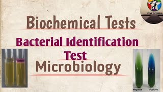 Biochemical Tests ll Bacterial Identification test ll Microbiology [upl. by Trini]