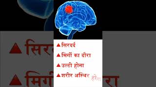 Brain Tumor Cancer Awareness Month Signamp Symptoms  Dr Amit Pandey  Apollo Hospital Lucknow [upl. by Allac174]