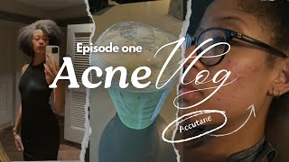 EPISODE 1 ACNE VLOG ACCUTANE  skincare [upl. by Eilarol]