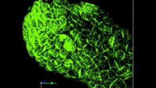 Microtubule dynamics in an Arabidopsis leaf [upl. by Refinneg]