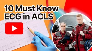 ACLS ECG Rhythms [upl. by Lehsreh544]