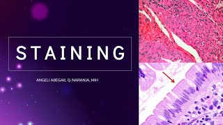 8 Staining Introduction Hematoxylin and Eosin HampE Histopathology Filipino [upl. by Yadnus]