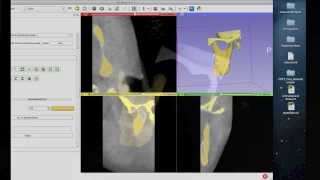 Tutorial Preparing Data for 3D Printing Using 3D Slicer [upl. by Tarrance]