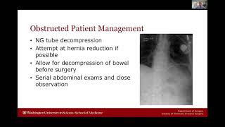 Obstructed amp Strangulated Hernia Management Lecture Video Surgery [upl. by Aras27]