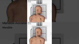 The xray of the mandible Axiolateral الوضعية الجانبية للفك السفلي [upl. by Jaella]