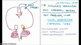 Easy Ways to Remember Cerebral Herniation [upl. by Schapira]