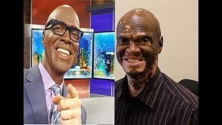 Lee Thomas  News Anchor Movie Critic and Turning White [upl. by Cad749]