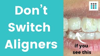 DON’T SWITCH ALIGNERS IF YOUR TEETH ARE NOT TRACKING l Dr Melissa Bailey Orthodontist [upl. by Inami]