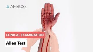 Modified Allen Test  Clinical Examination [upl. by Enamrahc259]