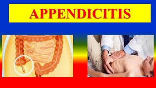 APPENDICITIS  definition causes pathophysiology  clinical features  diagnosis  management [upl. by Giulietta567]