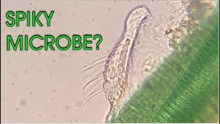 Hairy Microscopic Animals Gastrotrichs Stentors and Cyanobacteria [upl. by Rednijar88]