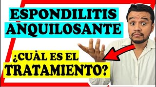 💥ESPECIAL ESPONDILITIS ANQUILOSANTE  TRATAMIENTO Y RECOMENDACIONES TERAPIA BIOLOGICA [upl. by Anilet753]