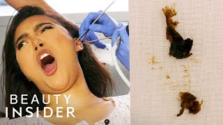 How Earwax Is Professionally Extracted  Beauty Explorers  Insider Beauty [upl. by Brenk908]