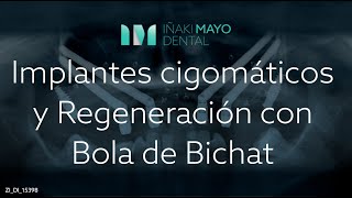 Colocación de Implantes Cigomáticos y Regeneración con bola de Bichat [upl. by Bandur]