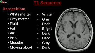 MRI Sequences  Radiology Buzz [upl. by Sabino84]