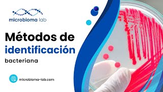 🦠🧫 ¿Qué TÉCNICAS existen para IDENTIFICAR BACTERIAS 🦠🧫 [upl. by Gad729]