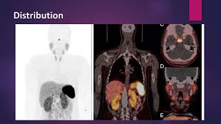 Neuroendocrine Tumors imaging with Ga 68 Somatostatin analogs MCQ nuclearmedicineMCQ [upl. by Clay]