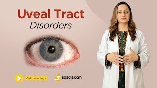 Uveal Tract Disorders  Ophthalmology Video Lecture  Medical Education  VLearning [upl. by Craig633]