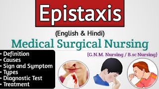 Epistaxis ent lecture  Epistaxis in hindi  Nosebleed [upl. by Elenahc816]