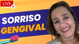 Sorriso gengival [upl. by Mannuela]