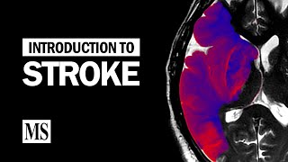 Introduction To Stroke [upl. by Euqinomahs625]