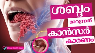 ശബ്ദത്തിലുണ്ടാകുന്ന മാറ്റം കാൻസറോ  Ethnic Health Court [upl. by Edroi60]