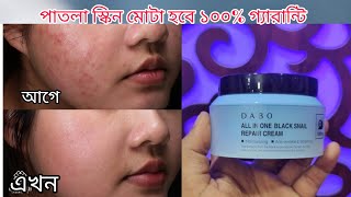 Get MOTA Skin in 7 Days with DABO All In One Black Snail Cream khadija begum [upl. by Yeloc]