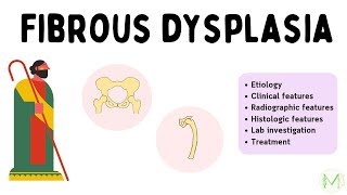 Fibrous dysplasia  In just 6 minutes  Easy explanation  Medinare [upl. by Ecienahs]