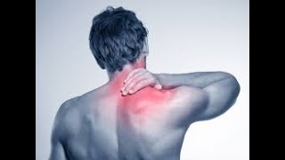 Upper Cross Syndrome  Fix your Posture and Low NeckUpper Back Pain [upl. by Eceerahs]