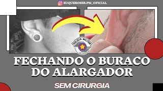 COMO FECHAR O BURACO DO ALARGADOR SEM TER QUE OPERAR EXAME MÉDICO PMSP [upl. by Adnilym340]