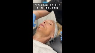 ✨Chemical Peel✨ [upl. by Fagan871]