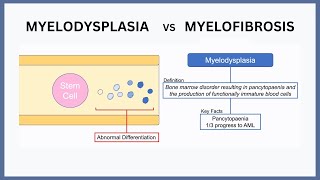 Myelodysplasia vs Myelofibrosis Explained [upl. by Noillid]