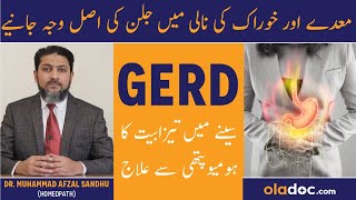 GERD Symptoms amp Treatment  Maiday Ki Tezabiat Ka Ilaj  Khurak Ki Nali Men Jalan  Homeopathy [upl. by Onairda]