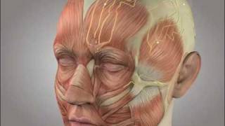 Migraine surgery video animation [upl. by Adok404]