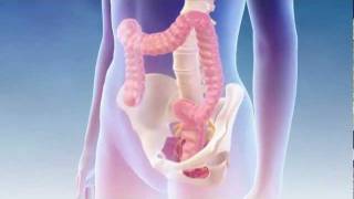 Fecal Incontinence  Interstim Bowel Mechanism of Action [upl. by Jezabelle]