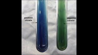 Citrate Utilization Test [upl. by Negam243]