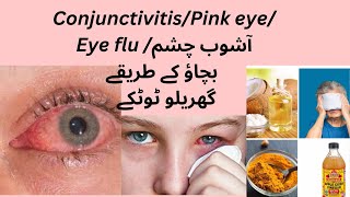 Conjunctivitis Causes symptoms and treatment of conjunctivitis [upl. by Horsey555]