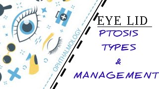 EYELID LECTURE7 PTOSIS TYPES ETIOLOGY TREATMENT [upl. by Ofella408]