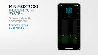 MiniMed 770G System – New Diabetes Management Technology [upl. by Huberto]